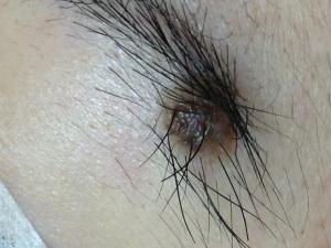 a distinct black mole hiding inside the left eyebrow