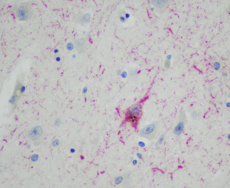 Home [www.crarylab.org]