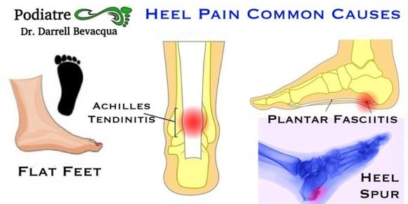 Podiatrist Specialist Achilles Tendinitis & Heel Pain.