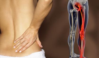 Sciatic Nerve Pain Treatments in Atlanta