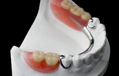 prothèse partielle mettallique Brossard-Laprairie, partial metal denture Brossard-Laprairie