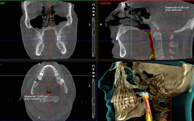 Planmeca ProMax 3D Clinique Implantologie Dentaire