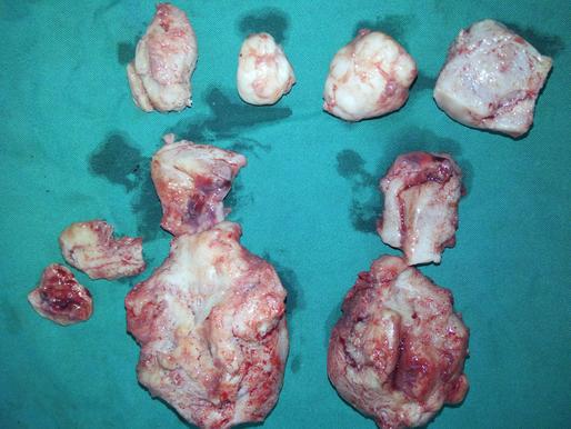 best uterus removal surgeon vasco