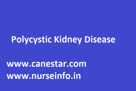 POLYCYSTIC KIDNEY DISEASE – Pathophysiology, Clinical Manifestations, Diagnostic Evaluations and Management