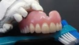 Removable Immediate Denture Michel Puertas Denturologiste Brossard-Laprairie