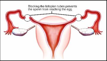 laparoscopic surgeon in goa
