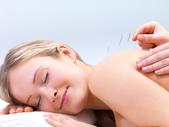 Lady laying on table getting acupuncture needles put in her back