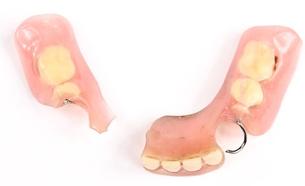 rèparation prothèse 1 heure Brossard-Laprairie, 1 hour denture repair Brossard-Laprairie