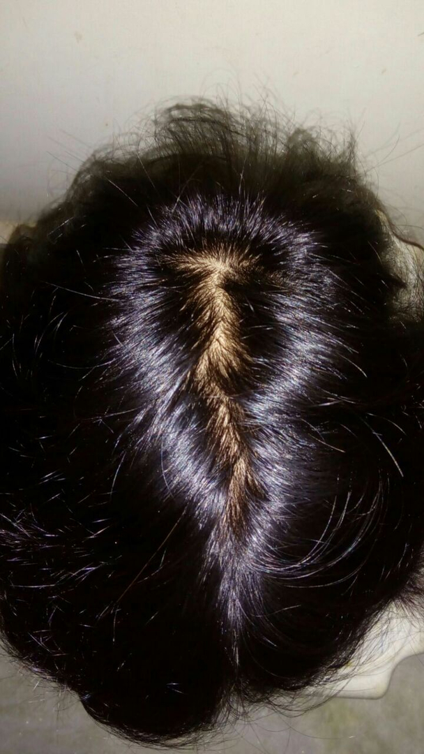 Wig in Delhi, Hair Patch in Delhi, - AHMED WIGS