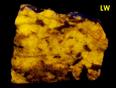fluorescent SCAPOLITE WERNERITE Meionite-Marialite, TREMOLITE, Pyrite – Grenville Scapolite Prospect, Grenville-sur-la-Rouge, Argenteuil RCM, Laurentides, Quebec, Canada - ex Alan Delany SB#31-47