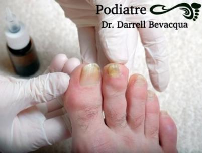 Toenail Fungus and Onychomycosis Solutions & Treatments.