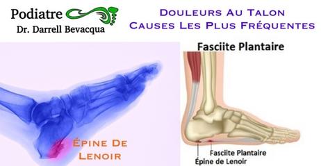 Douleur Au Talon Podiatre 25 ans d exp rience clinique