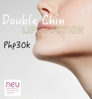 Double chin liposuction promo