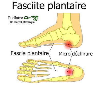 Douleur Au Talon Podiatre 25 ans d exp rience clinique