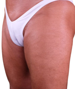MTF Tucking Techniques