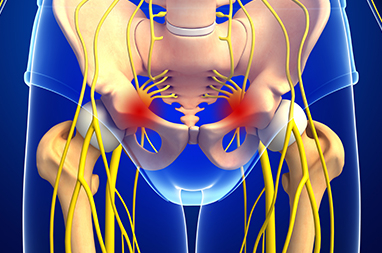 Pudendal Nerve Entrapment relief 