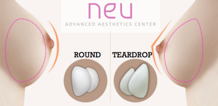 Top breast implant augmentation clinic in the Philippines NEU