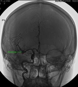 Virginia Brain & Spine Center - Pain Management ...