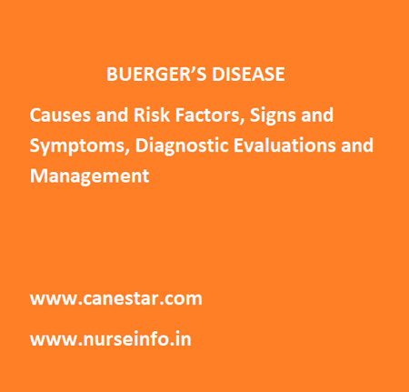 BUERGER’S DISEASE – Causes and Risk Factors, Signs and Symptoms, Diagnostic Evaluations and Management