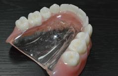 prothèse avec palais transparent Brossard-Laprairie, denture with transparent palate Brossard-Laprairie