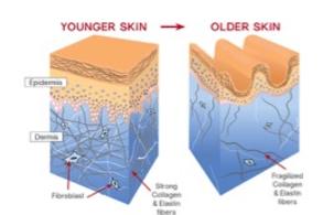 Cosmetic Injectables Center, Encino, Sherman Oaks Botox, Fillers, Restylane, Juvaderm, Collagen Stimulation