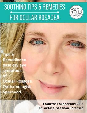 Ocular Rosacea Guide for Dry Eyes