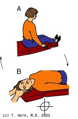 Posterior Canal BPPV easily cured Epley maneuver | BalanceMD