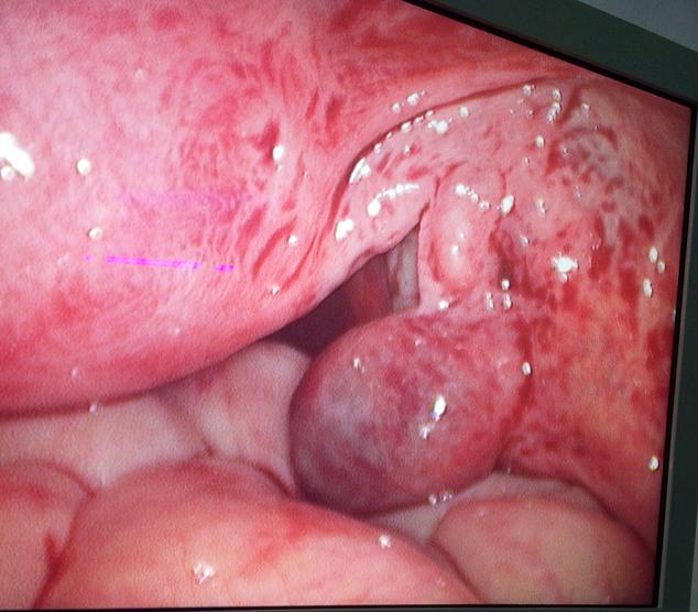 best laparoscopy hospital goa