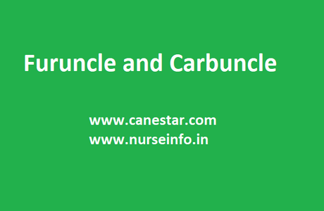 FURUNCLE and CARBUNCLE – Causes and Risk Factors, Clinical Manifestations, Treatment