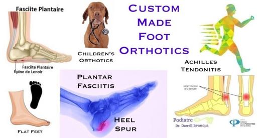 Custom on sale foot orthotics