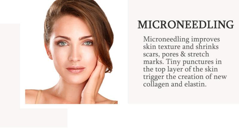 Microneedling model. Microneedling improves skin texture and shrinks scars, pores & stretch marks! Find out more below.