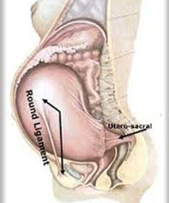 Round Ligament Pain