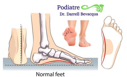 Flat Feet (Flatfoot): Types, Causes & Treatment