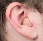 In-the-Canal Hearing Aid