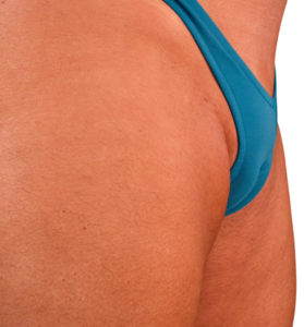 Transgender MTF Swimwear Designs