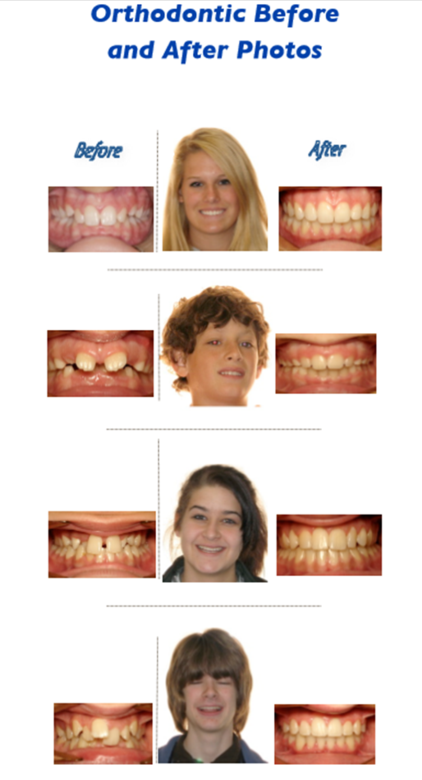 Orthodontic Before and After Photos