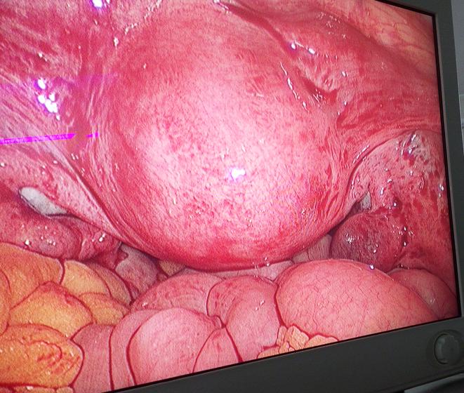 best laparoscopic gynecologist goa