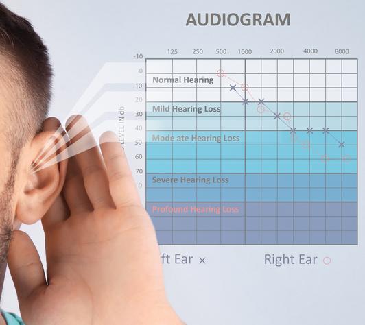 Audiogram