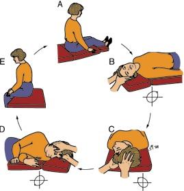 Posterior Canal BPPV easily cured Epley maneuver | BalanceMD