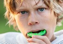 Mouthguards Michel Puertas Denturologiste Brossard-Laprairie