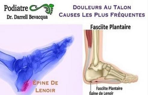 Verrue plantaire – Mon Podiatre – Clinique Podiatrique de l'Avenir