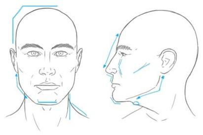 Cosmetic Injectables Center, Encino, Sherman Oaks Botox, Fillers, Restylane, Juvaderm, Radiesse, Men