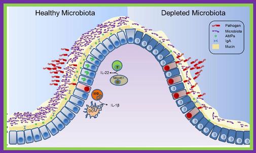 Gut Microbiome Disruption