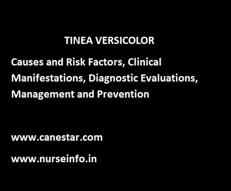 TINEA VERSICOLOR – Causes and Risk Factors, Clinical Manifestations, Diagnostic Evaluations, Management and Prevention