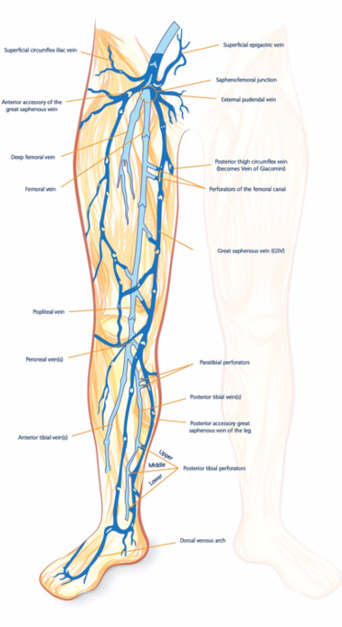 Ottawa Vein Centre - Vein Disease