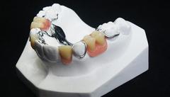 Partial Dentures Michel Puertas Denturologiste Brossard-Laprairie