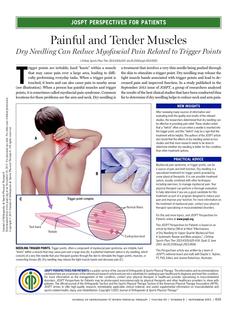 Trigger Point Dry Needling (TDN) - Boulder Therapeutics