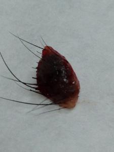 一粒被切出來的多毛的黑色的墨痣